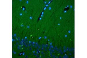 anti-CD90 (THY1) (AA 20-131) antibody