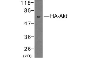 Image no. 1 for anti-HA-Tag antibody (ABIN319423) (HA-Tag anticorps)