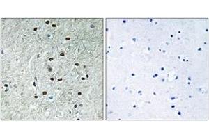Immunohistochemistry analysis of paraffin-embedded human brain, using REXO1 Antibody. (REXO1 anticorps  (AA 185-234))