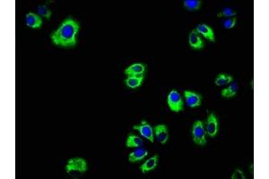 Immunofluorescence staining of HepG2 cells with ABIN7151894 at 1:166, counter-stained with DAPI.