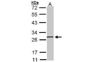WB Image Sample (30 ug of whole cell lysate) A: A431 , 10% SDS PAGE antibody diluted at 1:1000 (GK5 anticorps  (Center))
