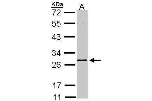GK5 anticorps  (Center)