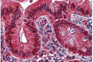 Human Colon: Formalin-Fixed, Paraffin-Embedded (FFPE)