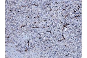 IHC analysis of EHD3 using anti-EHD3 antibody (ABIN7602777). (EHD3 anticorps  (C-Term))