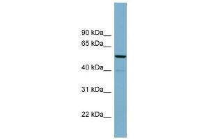 KIFC2 antibody used at 1 ug/ml to detect target protein. (KIFC2 anticorps  (N-Term))