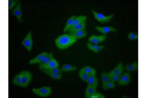 Immunofluorescence staining of HepG2 cells with ABIN7167470 at 1:266, counter-stained with DAPI. (RIPK1 anticorps  (AA 328-458))