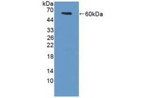 Western blot analysis of recombinant Mouse TGM1. (TGM1 anticorps  (AA 337-607))