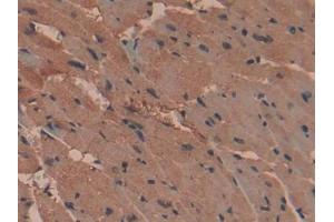 DAB staining on IHC-P; Samples: Mouse Heart Tissue
