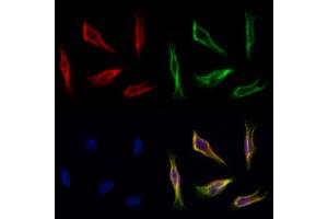 ABIN7094220 and ABIN7098266 staining Hela cells by IF/ICC. (FARS2 anticorps  (Internal Region))