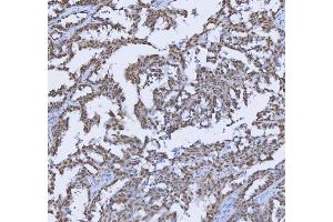 IHC analysis of TRMT6 using anti-TRMT6 antibody (ABIN7602138). (TRMT6 anticorps  (AA 6-489))
