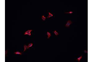 ABIN6266832 staining HeLa  cells by IF/ICC. (MAP4K4 anticorps  (Internal Region))