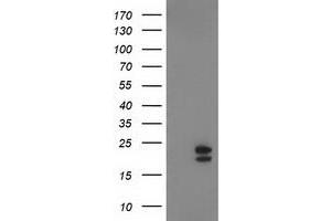 HEK293T cells were transfected with the pCMV6-ENTRY control (Left lane) or pCMV6-ENTRY NDUFB9 (Right lane) cDNA for 48 hrs and lysed.