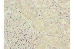Immunohistochemistry of paraffin-embedded human kidney tissue using ABIN7176063 at dilution of 1:100 (ZFYVE16 anticorps  (AA 1-280))