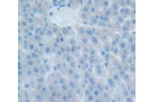 Figure. (EPOR anticorps  (AA 314-467))