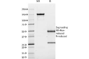SDS-PAGE Analysis Purified CD10 Mouse Monoclonal Antibody (MME/1620). (MME anticorps)