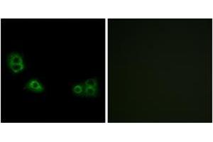 Immunofluorescence analysis of MCF7 cells, using TMEM185A Antibody. (TMEM185A anticorps  (AA 290-339))