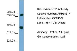 WB Suggested Anti-POT1  Antibody Titration: 0.