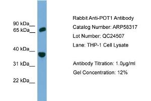 WB Suggested Anti-POT1  Antibody Titration: 0. (POT1 anticorps  (Middle Region))