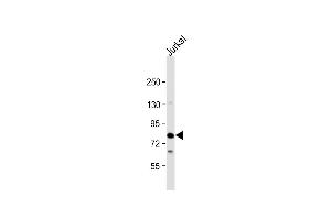 Anti-LCP2 Antibody (N-Term) at 1:2000 dilution + Jurkat whole cell lysate Lysates/proteins at 20 μg per lane.