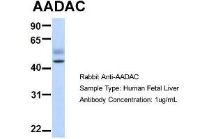 Host:  Rabbit  Target Name:  AADAC  Sample Type:  Human Fetal Liver  Antibody Dilution:  1. (AADAC anticorps  (N-Term))