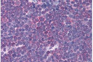 Human Thymus (formalin-fixed, paraffin-embedded) stained with CHRNA3 antibody ABIN214739 at 5 ug/ml followed by biotinylated goat anti-rabbit IgG secondary antibody ABIN481713, alkaline phosphatase-streptavidin and chromogen.