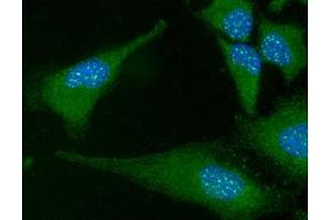 ICC/IF analysis of FADD in HeLa cells line, stained with DAPI (Blue) for nucleus staining and monoclonal anti-human FADD antibody (1:100) with goat anti-mouse IgG-Alexa fluor 488 conjugate (Green).
