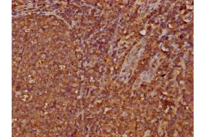 IHC image of ABIN7156081 diluted at 1:300 and staining in paraffin-embedded human tonsil tissue performed on a Leica BondTM system. (IGHA2 anticorps  (AA 36-111))