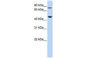 DPH2 antibody used at 1 ug/ml to detect target protein. (DPH2 anticorps)