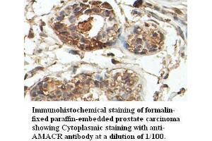 Image no. 1 for anti-alpha-Methylacyl-CoA Racemase (AMACR) antibody (ABIN791220) (AMACR anticorps)