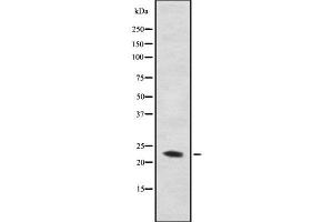 Western blot analysis of C56D2 using COS7 whole cell lysates (CYB561D2 anticorps)