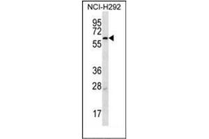Western blot analysis of MBTPS2 Antibody (N-term) in NCI-H292 cell line lysates (35ug/lane). (MBTPS2 anticorps  (N-Term))