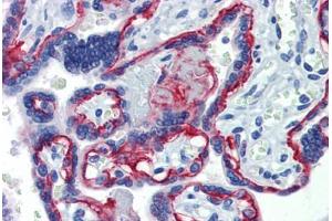 Placenta, Human: Formalin-Fixed, Paraffin-Embedded (FFPE) (Integrin beta 4 anticorps)