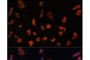 Immunofluorescence analysis of L929 cells using TMEM25 Polyclonal Antibody at dilution of 1:100. (TMEM25 anticorps)