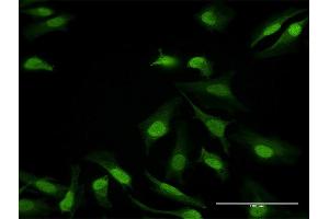 Immunofluorescence of purified MaxPab antibody to DDB1 on HeLa cell.