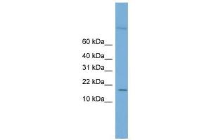 Cystatin 8 antibody used at 1 ug/ml to detect target protein. (CST8 anticorps)