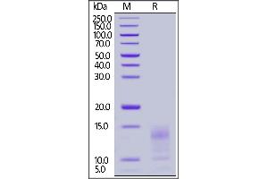 Human Mucin-1 (1), His Tag on  under reducing (R) condition. (MUC1 Protein (AA 1036-1155) (His tag))