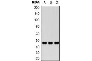Western blot analysis of Nocturnin expression in HEK293T (A), PC12 (B), HeLa (C) whole cell lysates.