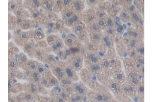Detection of CHRD in Mouse Liver Tissue using Polyclonal Antibody to Chordin (CHRD)