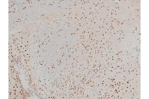 ABIN6267443 at 1/100 staining mouse brain tissue sections by IHC-P.