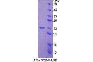 SDS-PAGE (SDS) image for Adrenomedullin (ADM) (AA 24-171) protein (His tag) (ABIN1879853)