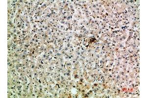 Immunohistochemical analysis of paraffin-embedded human-liver, antibody was diluted at 1:200 (TNIP2 anticorps  (AA 61-110))
