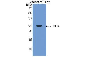 Detection of Recombinant DBP, Human using Polyclonal Antibody to Vitamin D Binding Protein (DBP) (Vitamin D-Binding Protein anticorps  (AA 209-401))