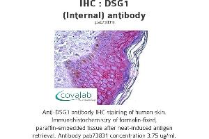 Image no. 1 for anti-Desmoglein 1 (DSG1) (Internal Region) antibody (ABIN1733615) (Desmoglein 1 anticorps  (Internal Region))