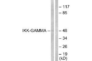 Immunohistochemical analysis of paraffin-embedded human lung carcinoma tissue using IKK-γ (Ab-31) Antibody. (IKBKG anticorps  (Ser31))