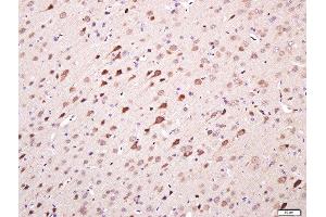 Paraformaldehyde-fixed, paraffin embedded rat brain tissue, Antigen retrieval by boiling in sodium citrate buffer(pH6) for 15min, Block endogenous peroxidase by 3% hydrogen peroxide for 20 minutes, Blocking buffer (normal goat serum) at 37°C for 30min, Antibody incubation with TMEM158 Polyclonal Antibody, Unconjugated  at 1:400 overnight at 4°C, followed by a conjugated secondary and DAB staining