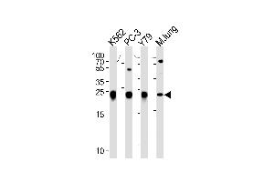 GSTP1 Antibody (Center) (ABIN1881393 and ABIN2842718) western blot analysis in K562,PC-3,Y79 cell line and mouse lung tissue lysates (35 μg/lane). (GSTP1 anticorps  (AA 97-126))