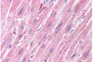 Human Heart (formalin-fixed, paraffin-embedded) stained with CRADD antibody ABIN213922 at 5 ug/ml followed by biotinylated goat anti-rabbit IgG secondary antibody ABIN481713, alkaline phosphatase-streptavidin and chromogen. (CRADD anticorps  (AA 99-117))