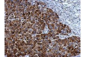 anti-Nucleolar Protein 3 (Apoptosis Repressor with CARD Domain) (NOL3) (AA 1-197) antibody