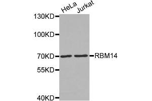 Western Blotting (WB) image for anti-RNA Binding Motif Protein 14 (RBM14) antibody (ABIN1874564) (RBM14 anticorps)