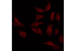 ABIN6268877 staining LOVO by IF/ICC. (MMP2 anticorps)
